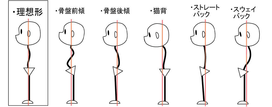 【スウェイバック姿勢】それ、肩こりや腰痛の原因かも？