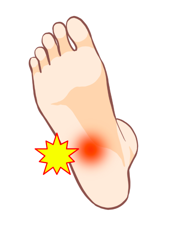 朝起きて一歩目が痛い…それは足底筋膜炎かも