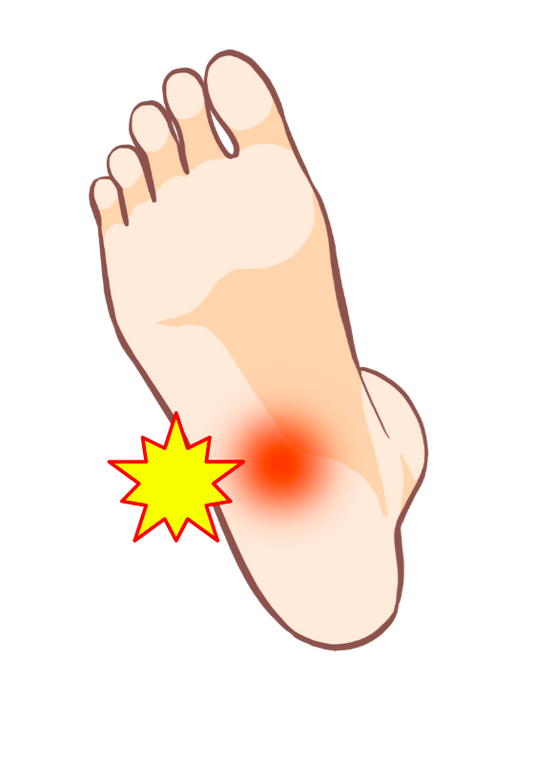 朝起きて一歩目が痛い…それは足底筋膜炎かも