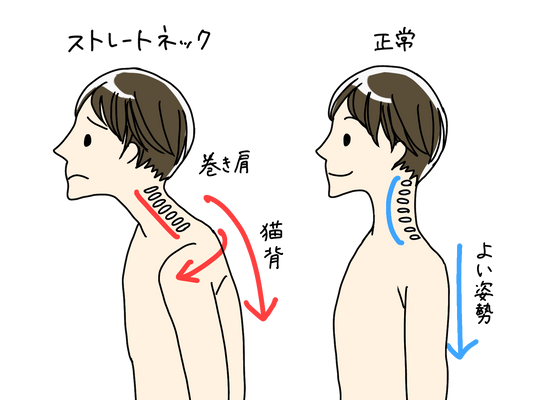 🌿「なんか気分が上がらない…」それ、姿勢かもしれません｜巻き肩とメンタルの関係